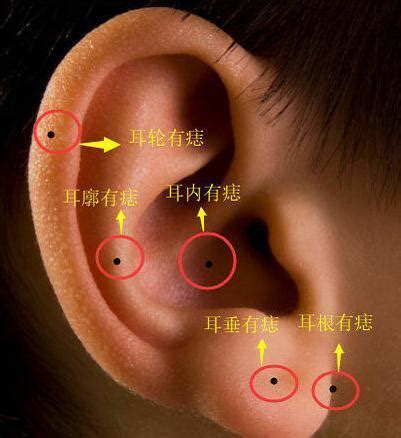 耳朵黑痣|耳朵长痣的位置图解 耳朵长痣的位置图解有福气